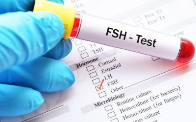 Kiedy oznaczać FSH, LH i estradiol?